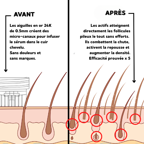 Cure Hair Boost & Regrowth®